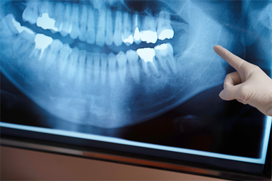 治療効果の確認と今後のケア